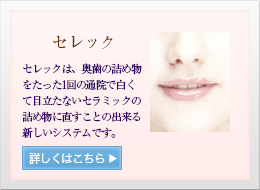セレック